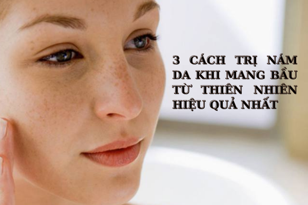 3 cách trị nám da khi mang bầu từ thiên nhiên hiệu quả nhất 