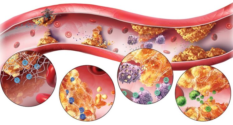 Ổn định cholesteron